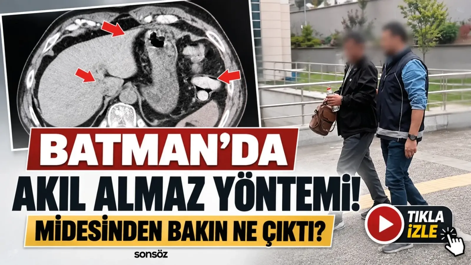 Batman’da akıl almaz yöntemi! Midesinden bakın ne çıktı?