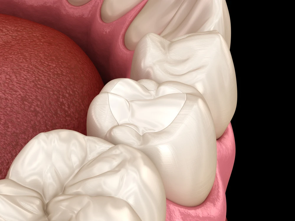 Estetik Dolguların Ömrünü Alışkanlıklarımız Belirliyor