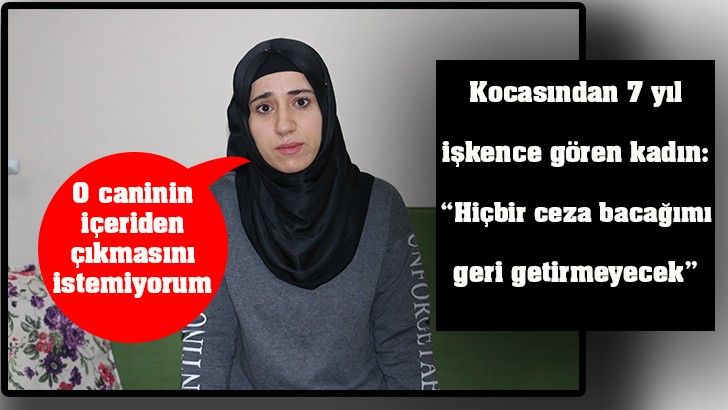 Kocasından 7 yıl işkence gören kadın: “Hiçbir ceza bacağımı geri getirmeyecek” 